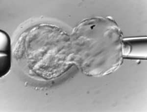 blastocyst