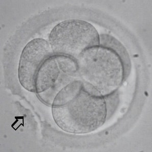 assisted hatching of a blastocyst