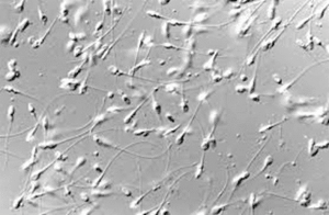 sperm