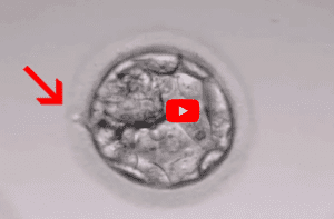 assisted hatching
